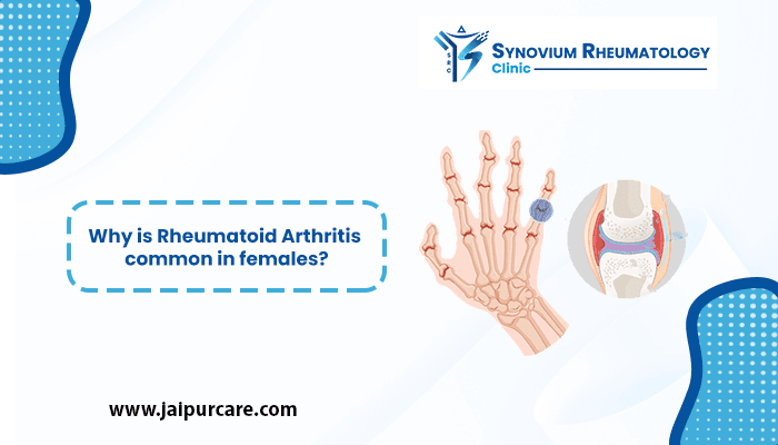 rheumatoid arthritis common in females