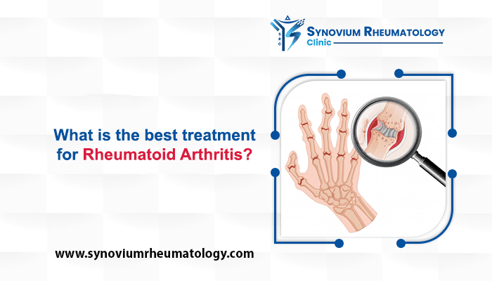 Treatment for Rheumatoid Arthritis in 2022