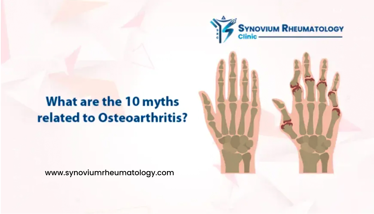 10 myths related to Osteoarthritis