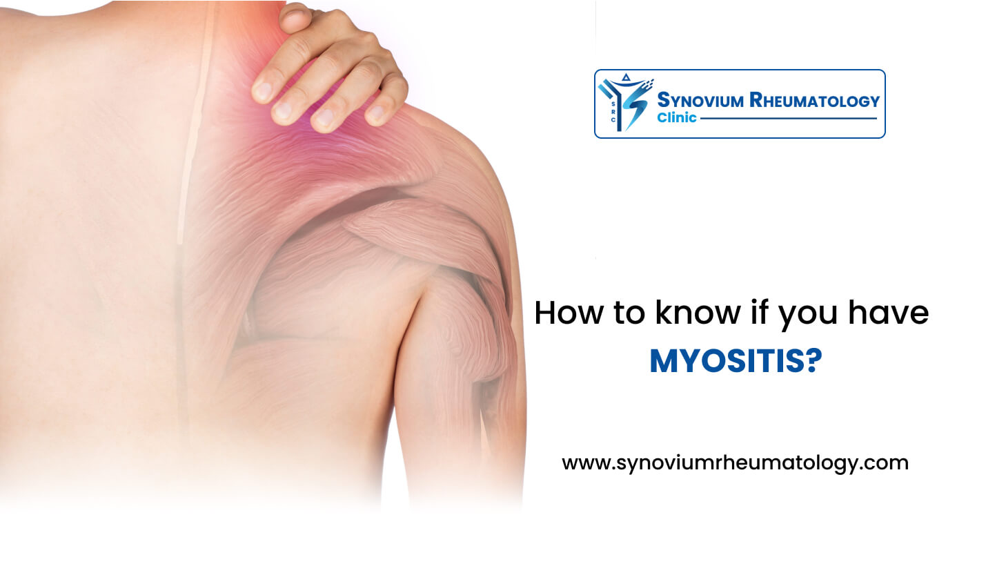 How to Know If You Have Myositis