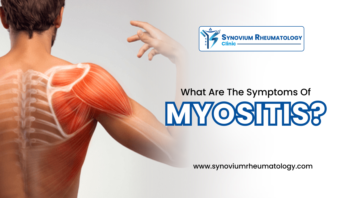 symptoms of Myositis