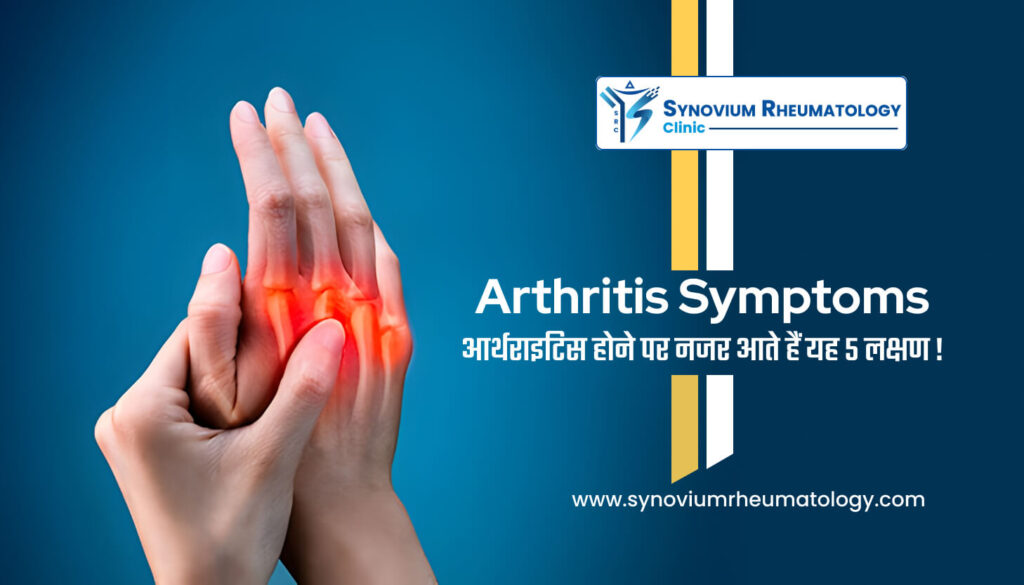 Arthritis Symptoms in Hindi आर्थराइटिस होने पर नजर आते हैं यह 5 लक्षण