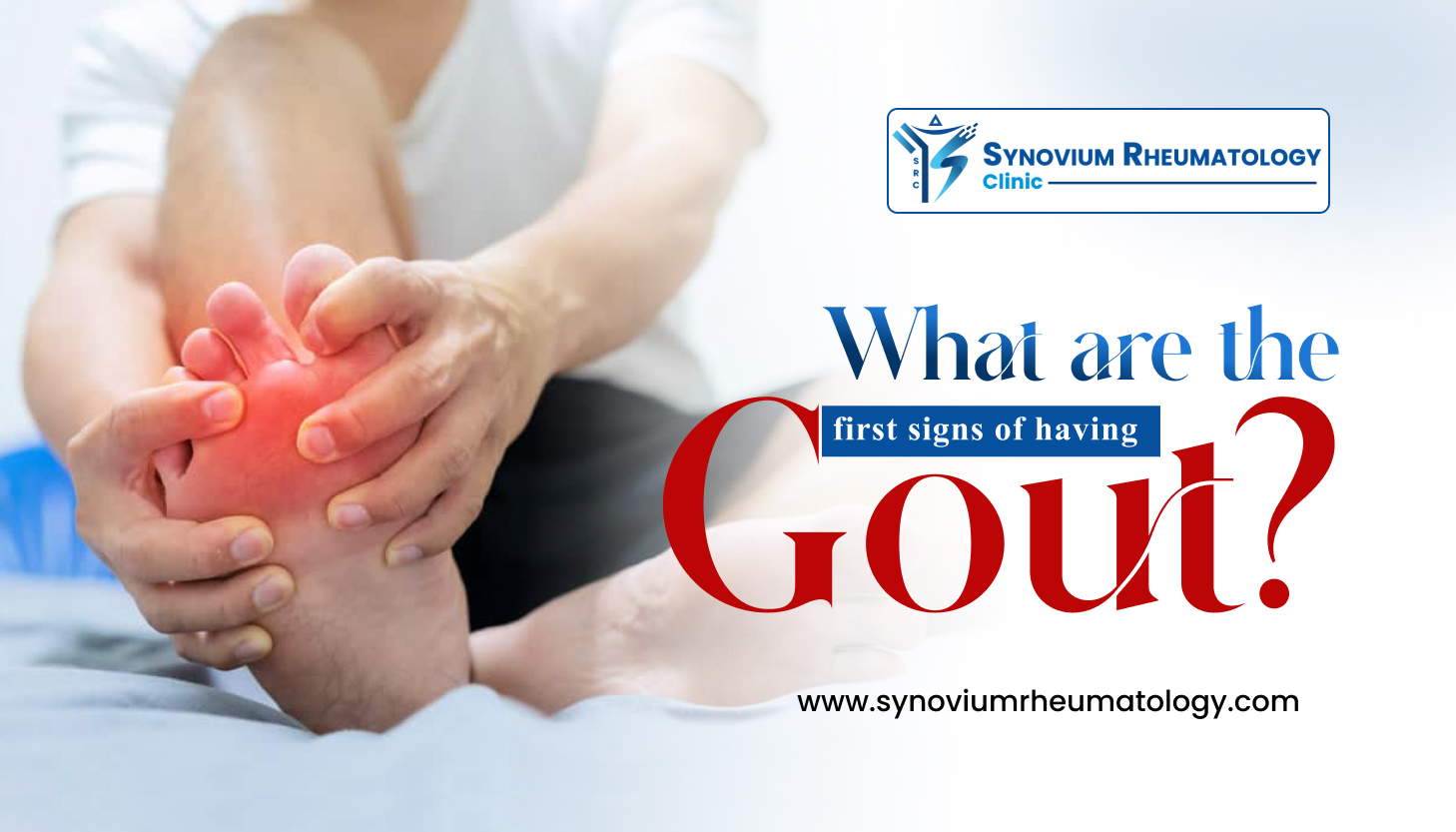 What are the first signs of having Gout? | Synovium Rheumatology