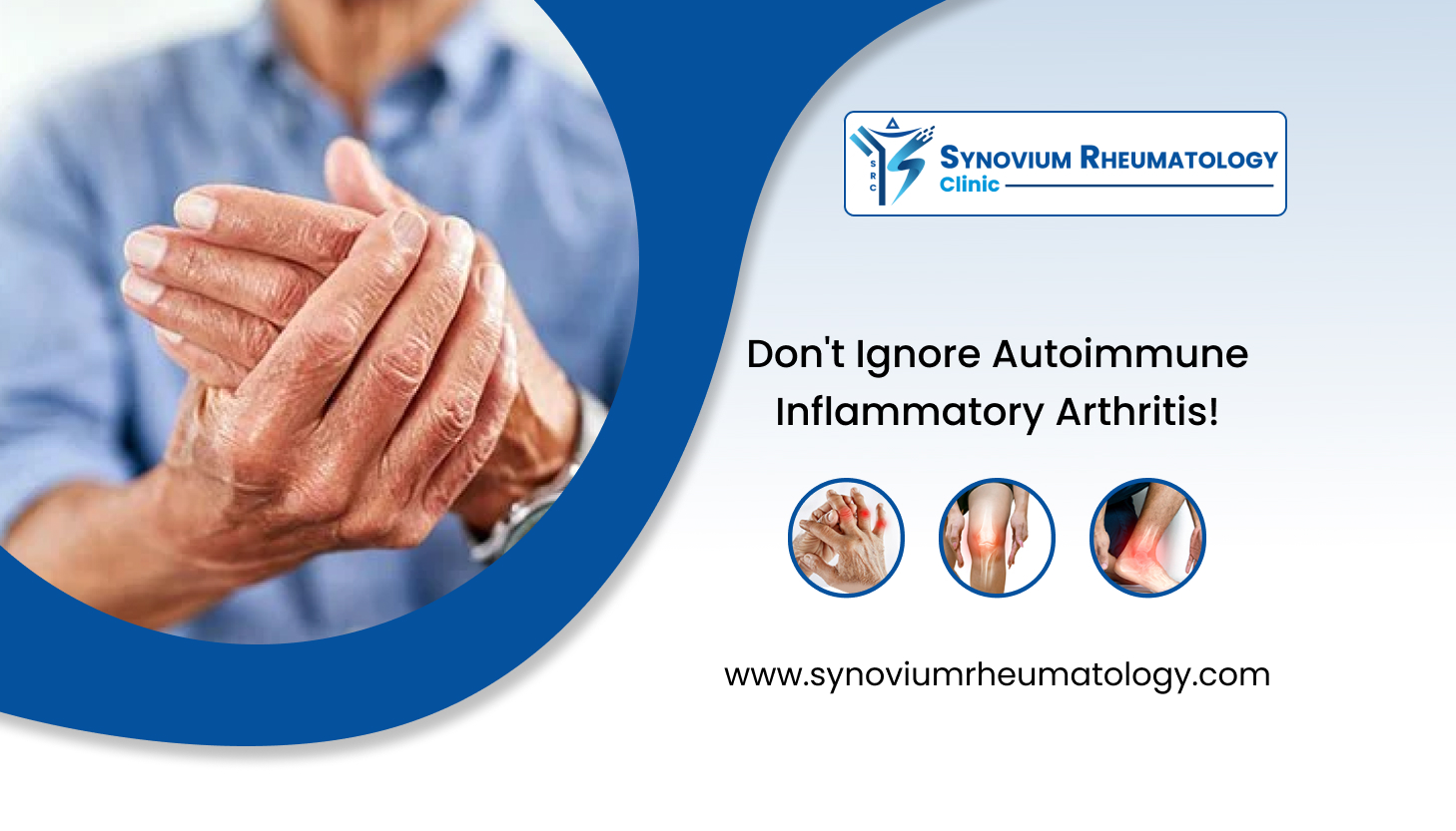 Don't Ignore Autoimmune Inflammatory Arthritis [2022]